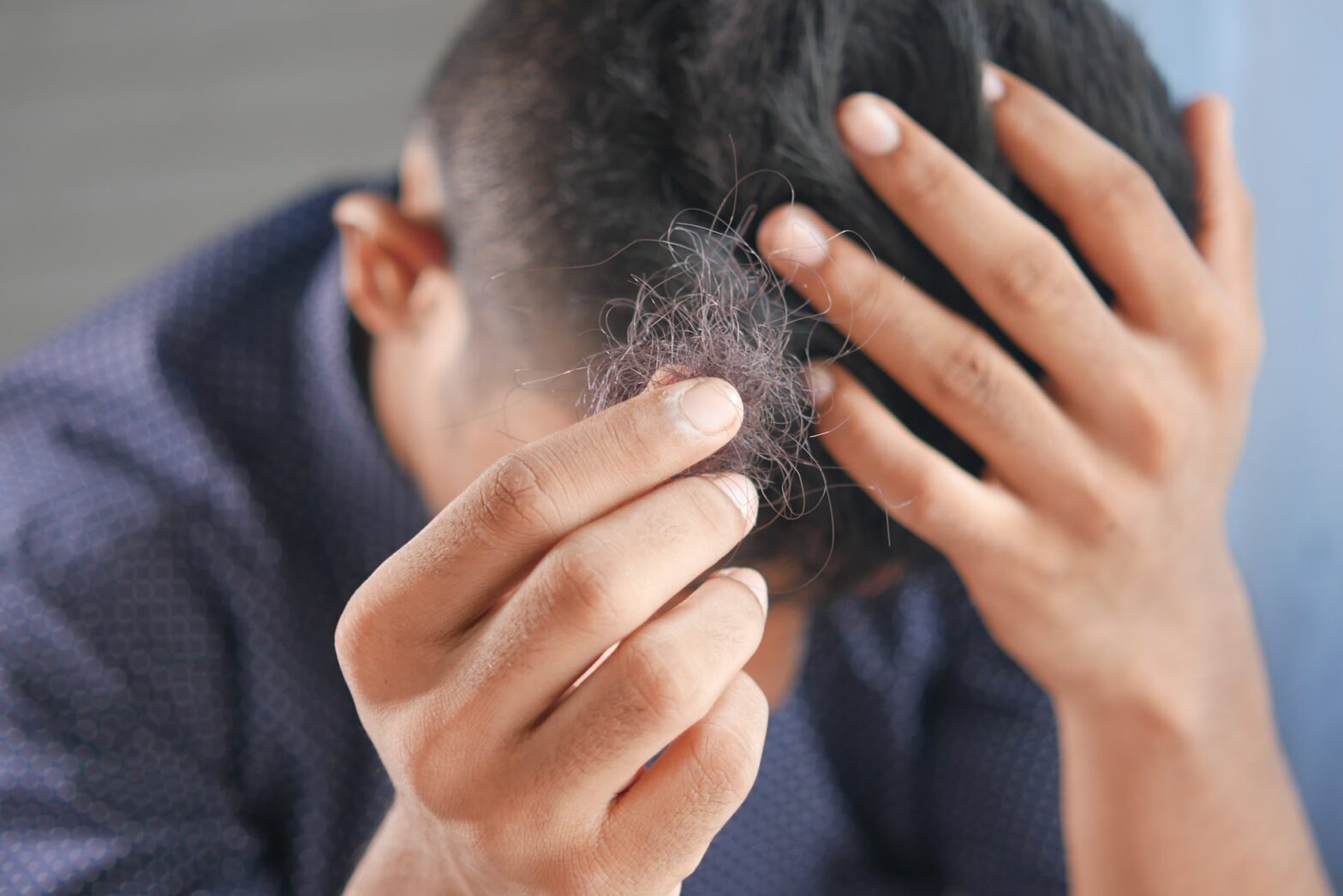 Wenn ein Roboter die Haartransplantation macht