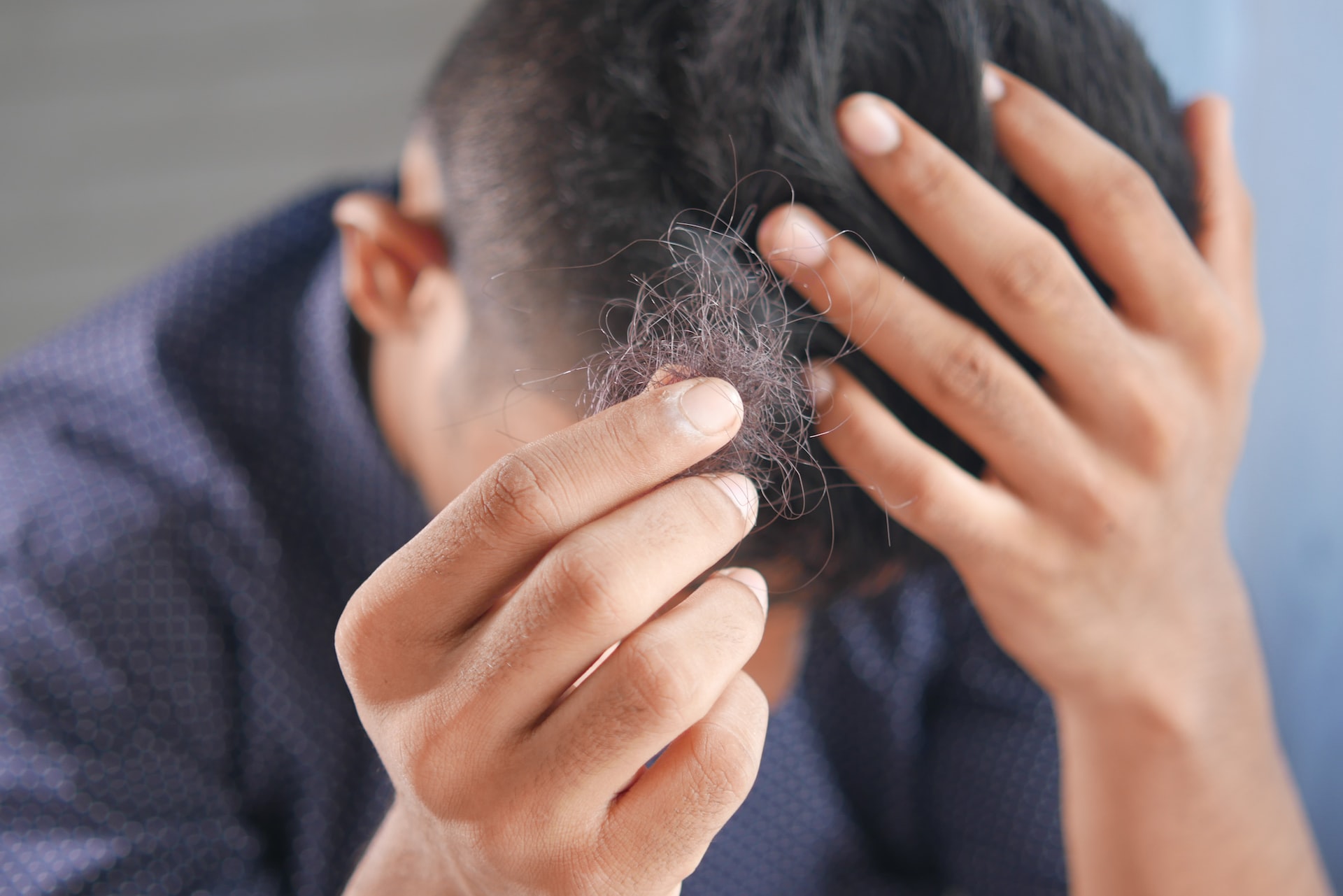 Wenn ein Roboter die Haartransplantation macht